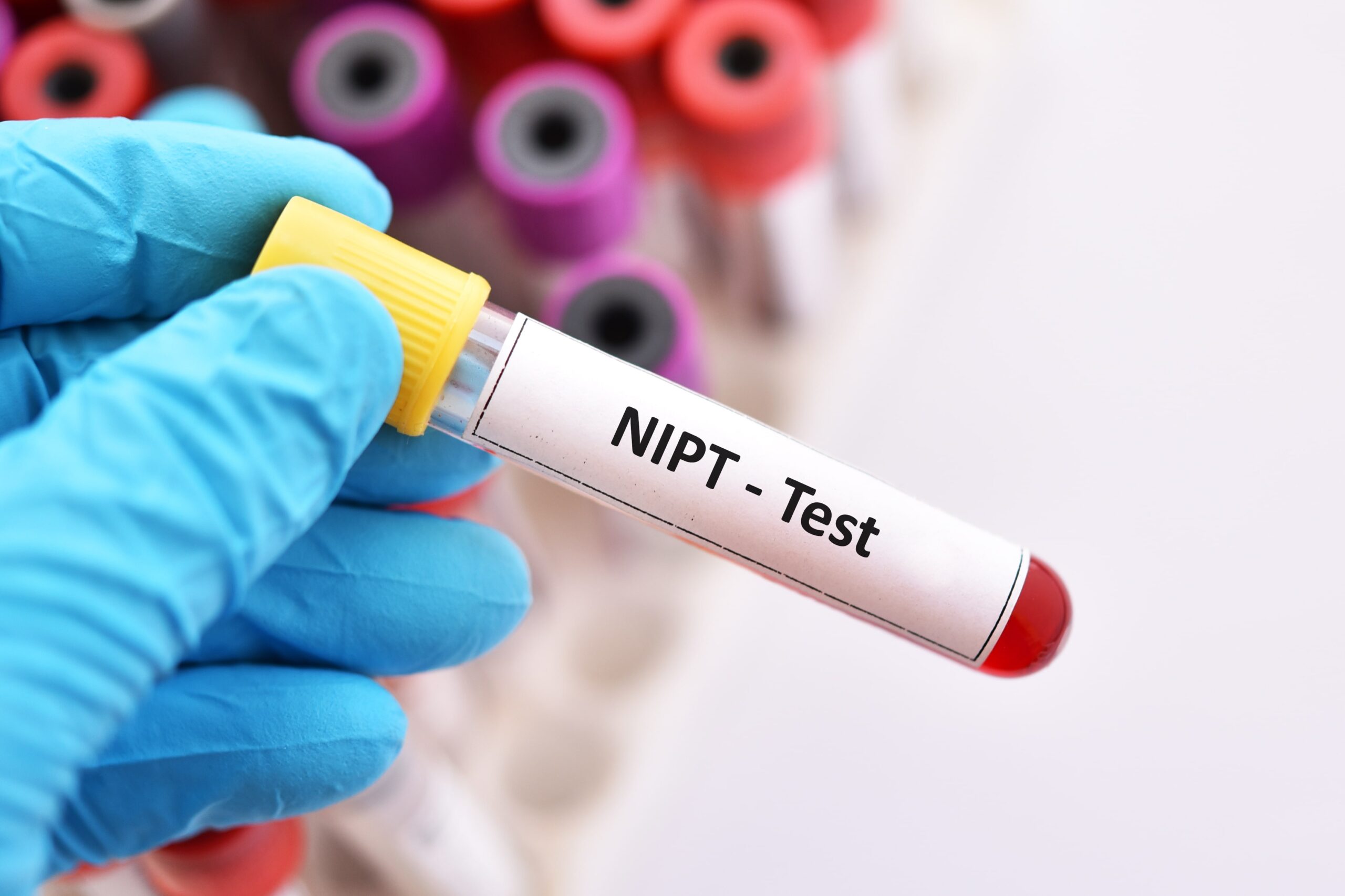 May 2022: NIPT tests